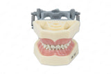 Typodont Model 760P (pediatric) and Teeth