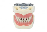 Typodont Model 860 with Pre Prepped Teeth