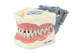 Typodont Model 860 with Pre Prepped Teeth