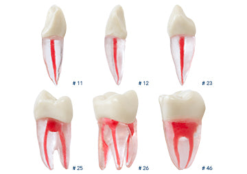 Ivorine Teeth with Root  Endodontic  (use chart in 2nd pic for ref #)